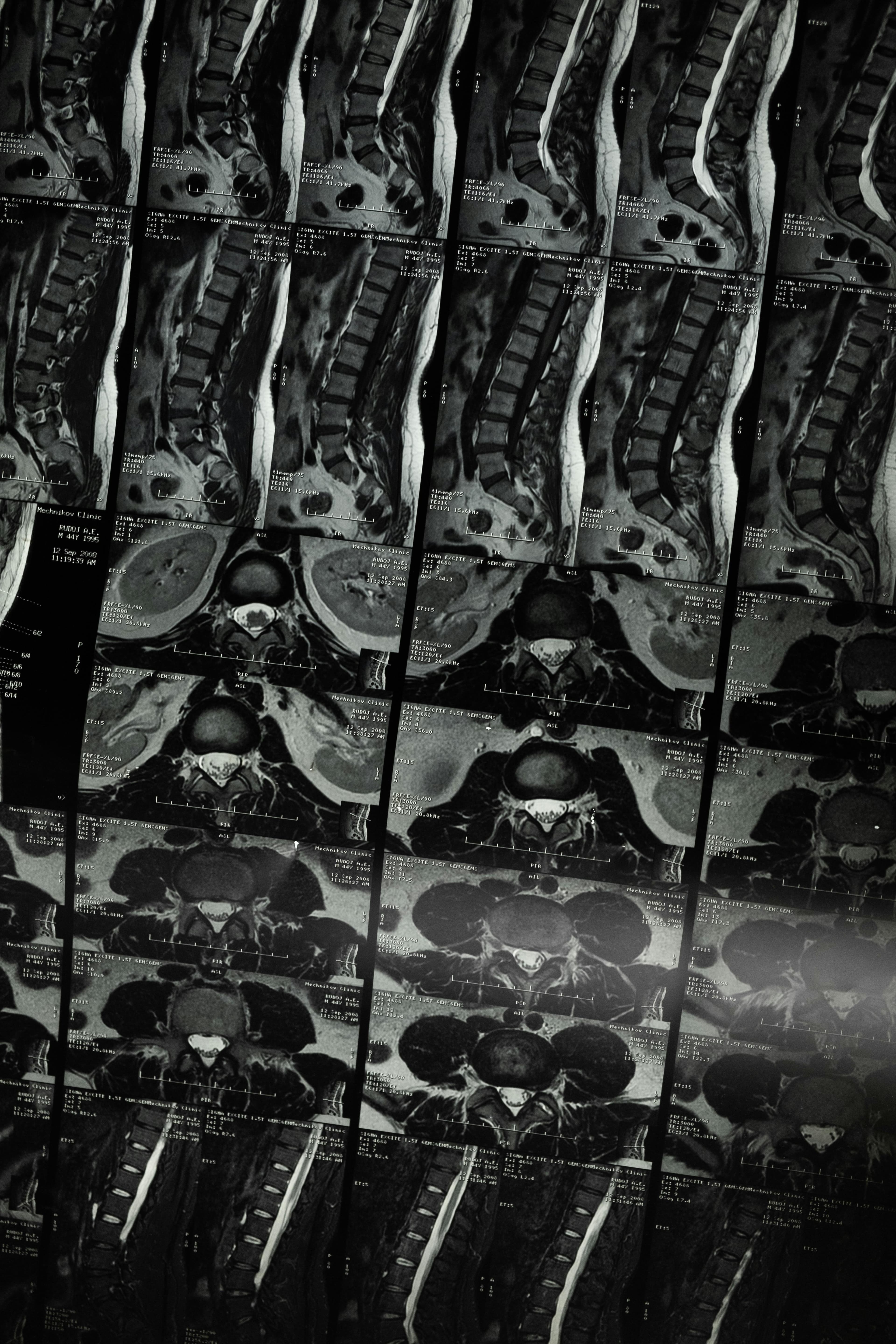 Spinal Imaging at Fairview Imaging Center